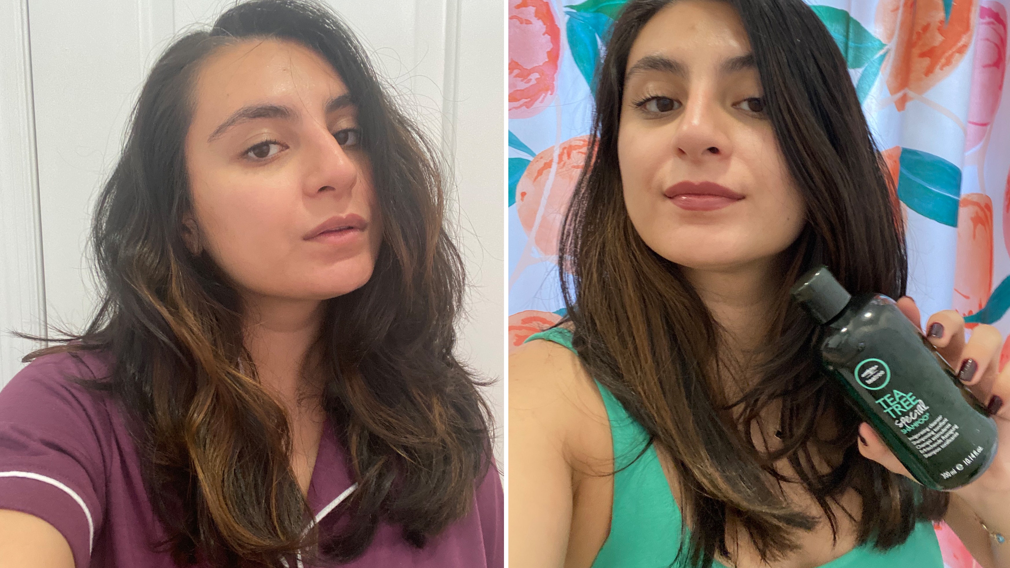 Acabo de romper con la caspa gracias a este champú de 15 dólares