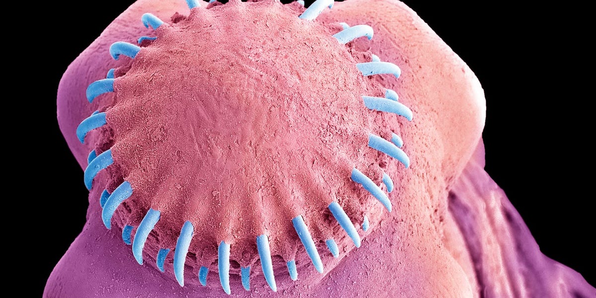 Un hombre es hospitalizado tras descubrir una tenia en su cerebro