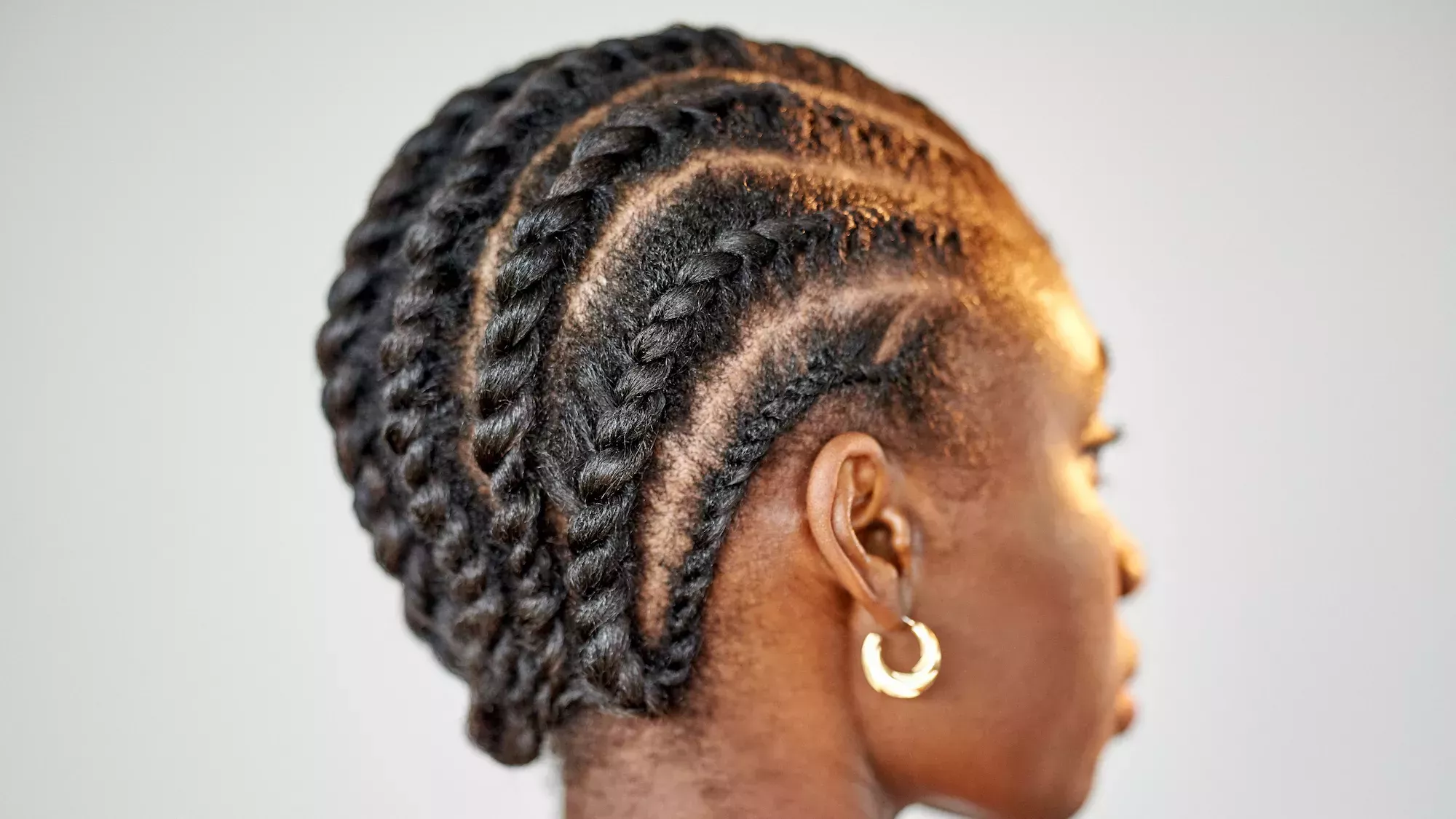 Cómo saber si la alopecia por tracción es la causa de la caída del cabello