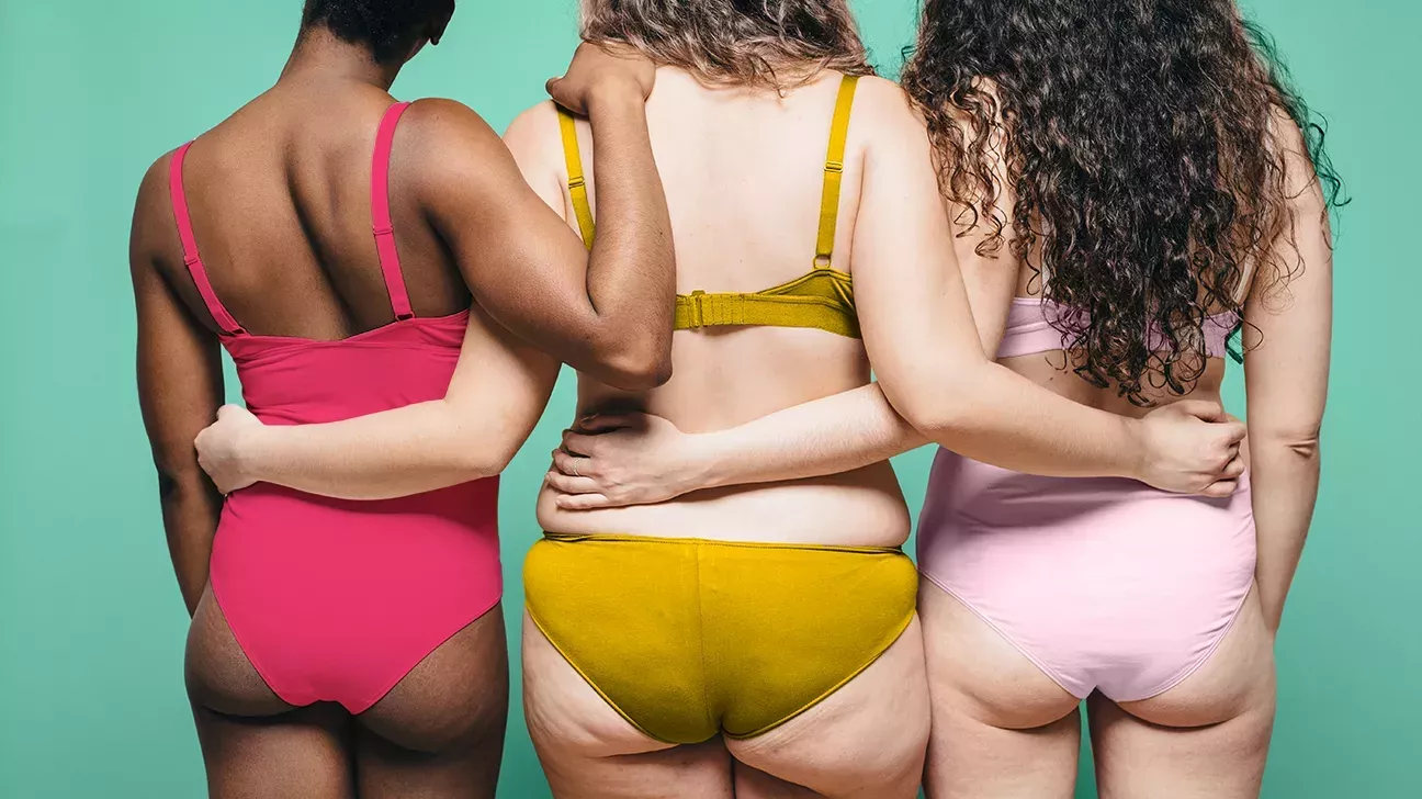 ¿Qué es la celulitis? Por qué la tienes y cómo decirle adiós