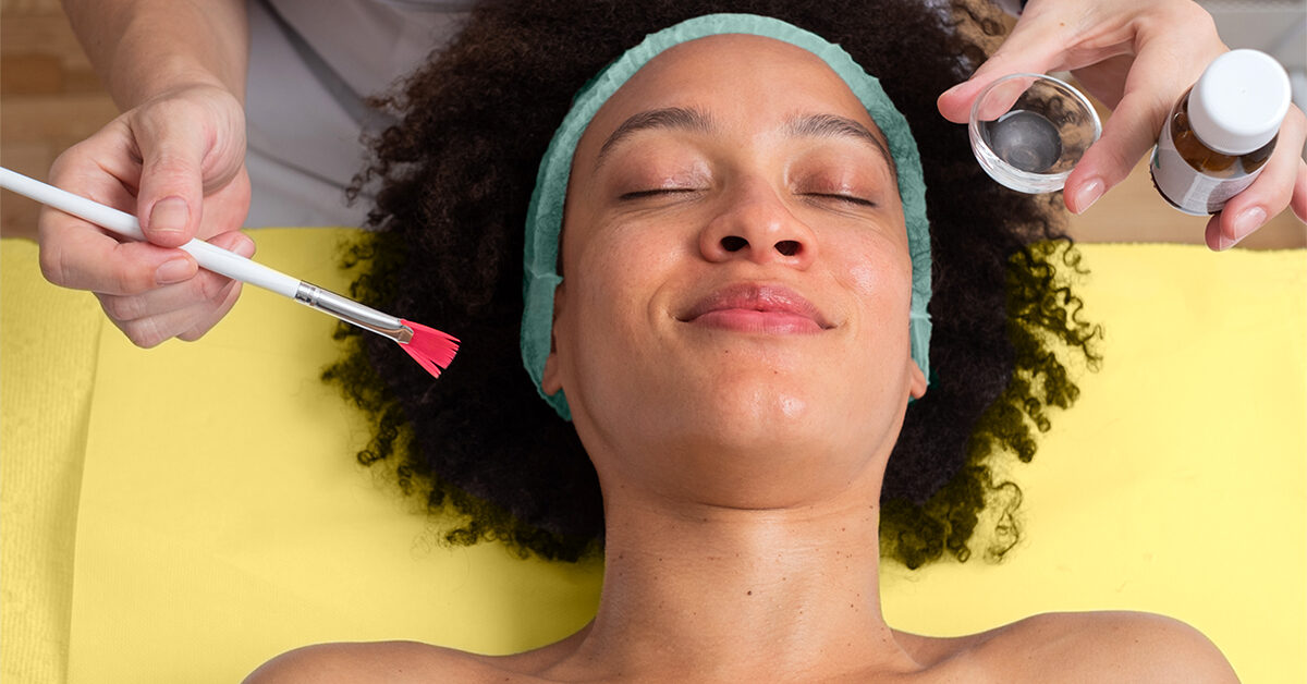 Exfoliaciones químicas para las cicatrices del acné: ¿Solución milagrosa o sólo un tratamiento para las cicatrices?