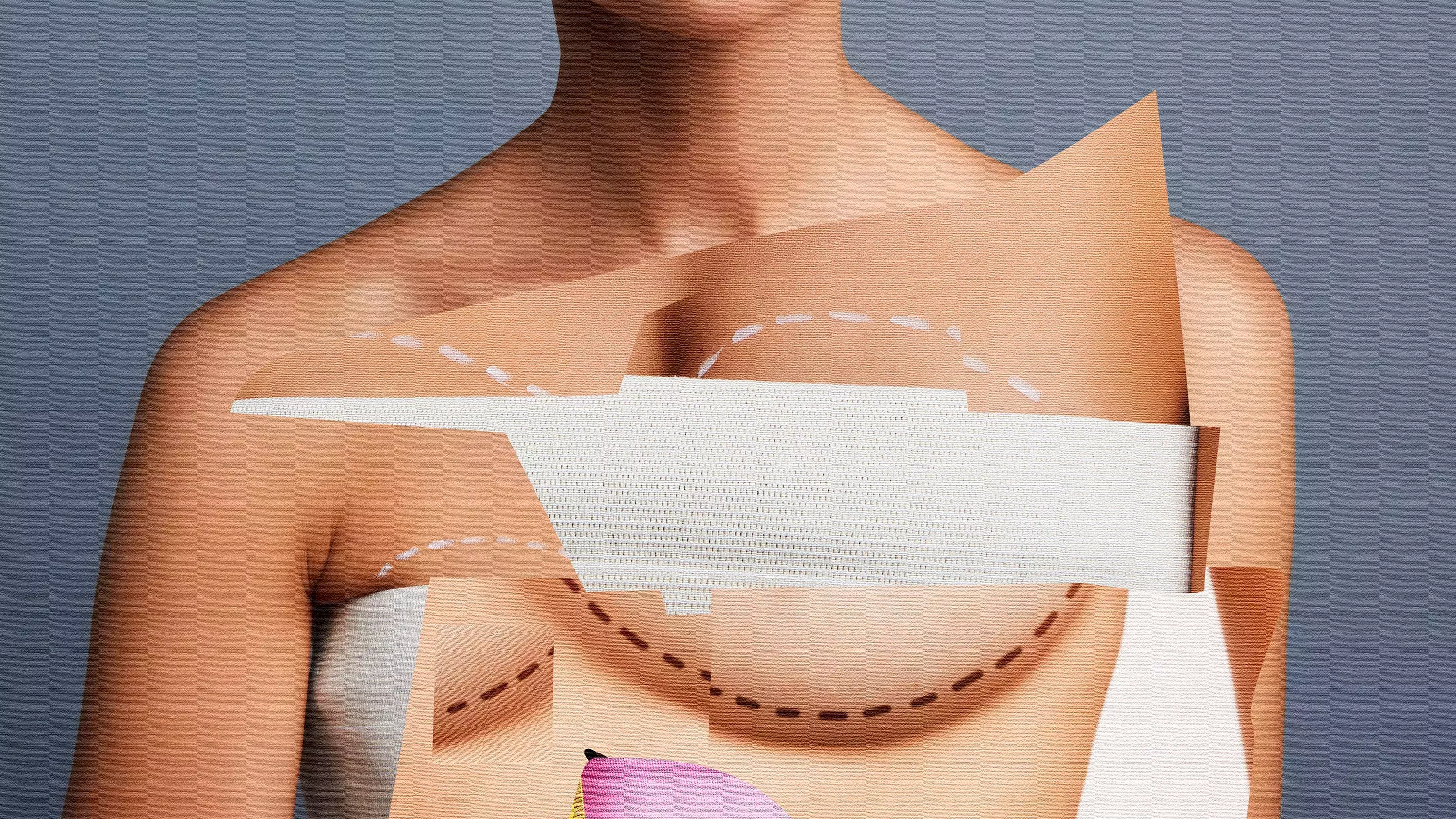 El auge de las fotos engañosas del antes y el después de la cirugía plástica