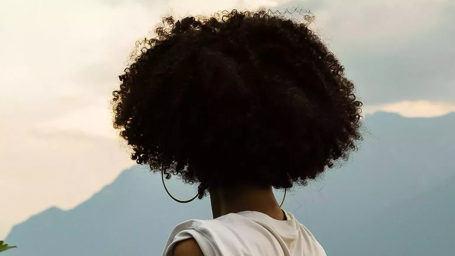 Estos médicos están haciendo que los trasplantes de pelo sean más accesibles para los pacientes negros