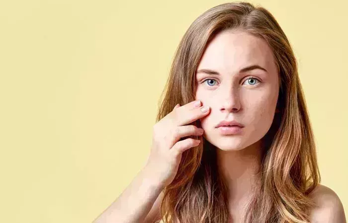 15 consejos esenciales para el cuidado de la piel de los adolescentes