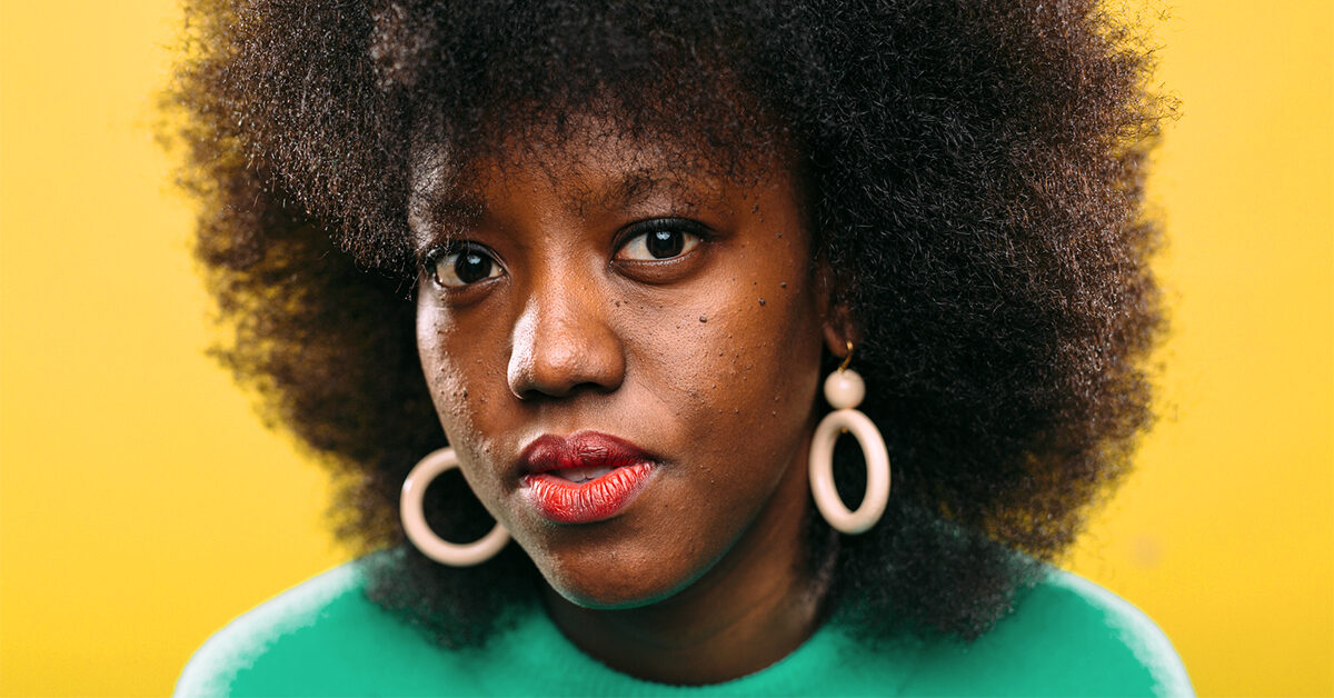 Así es la hiperpigmentación por acné y 12 formas de tratarla