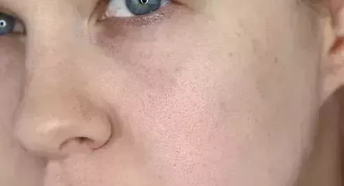 C&oacute;mo hacer que los poros sean m&aacute;s peque&ntilde;os con el maquillaje - Tutorial y consejos