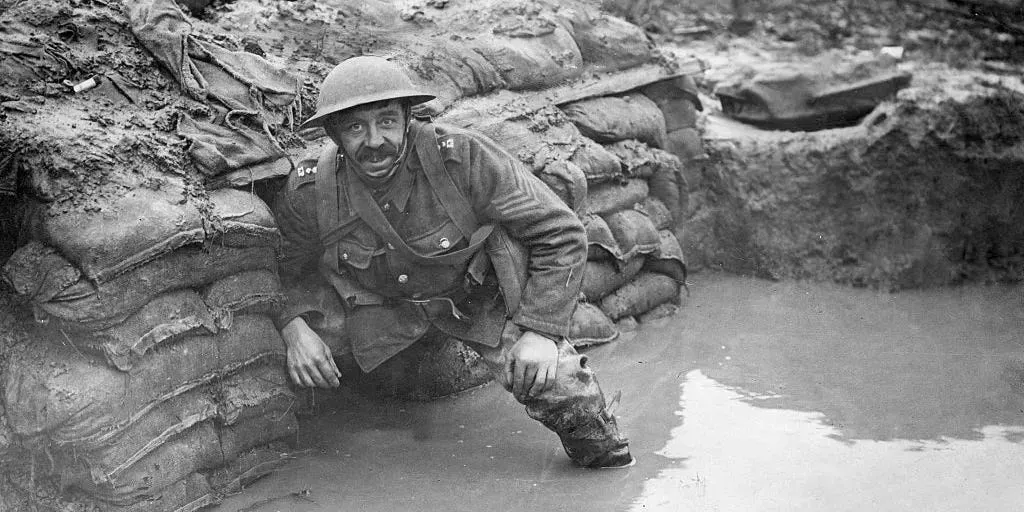Cómo reconocer y tratar el pie de trinchera, la mortal enfermedad que se cobró miles de vidas en la Primera Guerra Mundial
