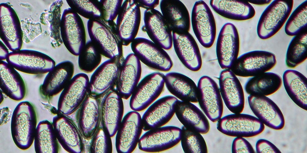 8 razones por las que te pica el agujero del culo y cómo conseguir un rápido alivio