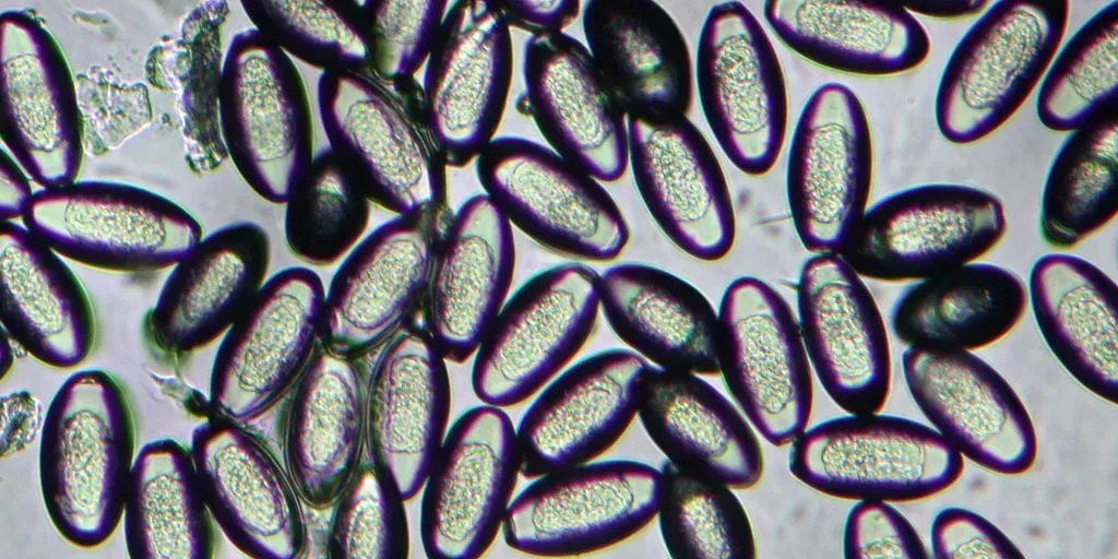 8 razones por las que te pica el agujero del culo y cómo conseguir un rápido alivio