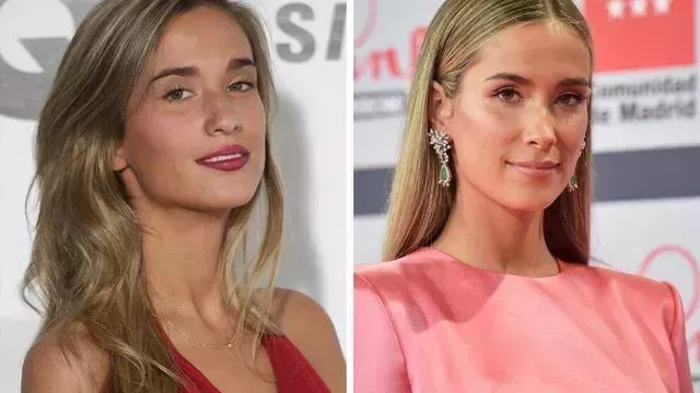 Tipos De Cirug as Realizadas Por Las Celebrities En Espa a Estarguapas Tipos De Cirug as Realizadas Por Las Celebrities En Espa a Estarguapas