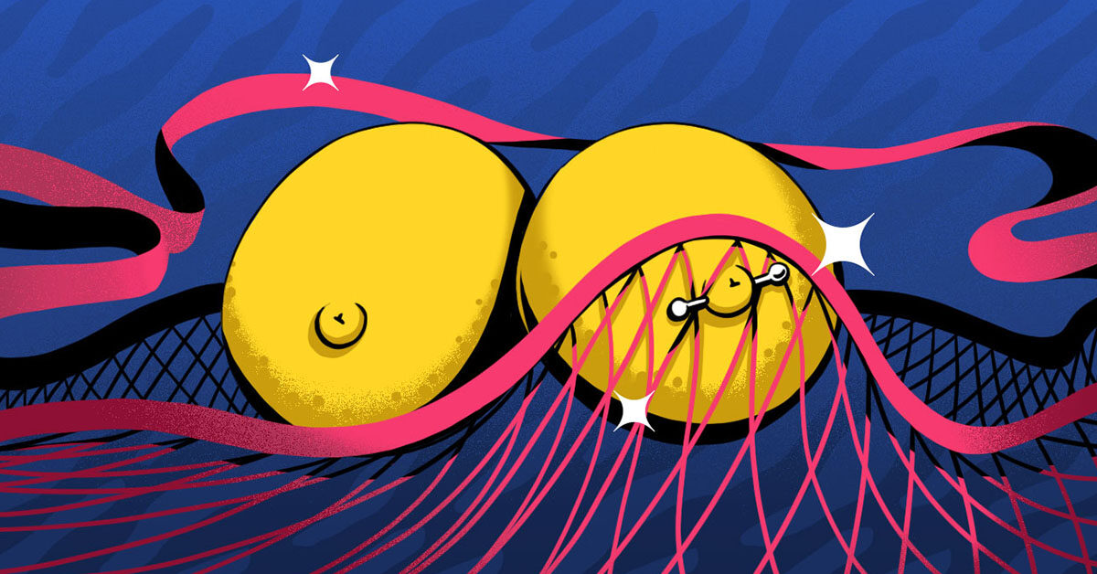 Piercings en el pezón: Beneficios, dolor, coste y más