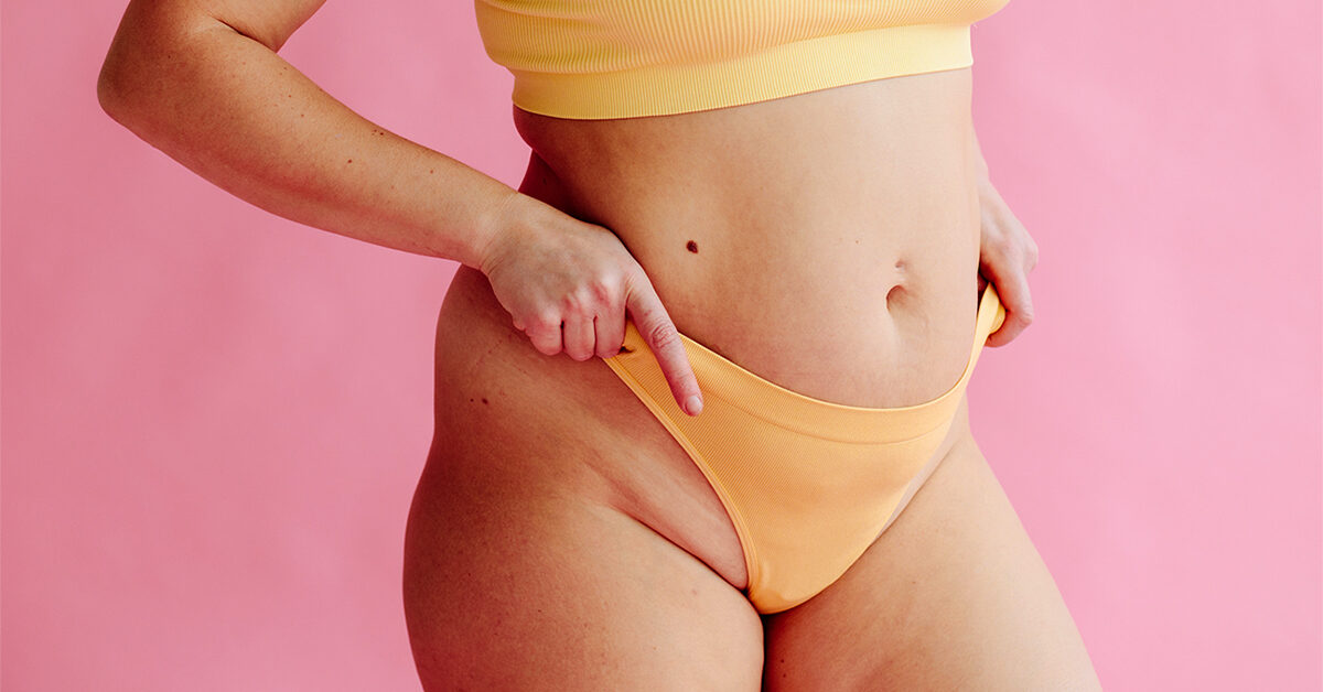 ¡Ayuda! ¿Cómo puedo eliminar las quemaduras de la maquinilla de afeitar en la zona del pubis?