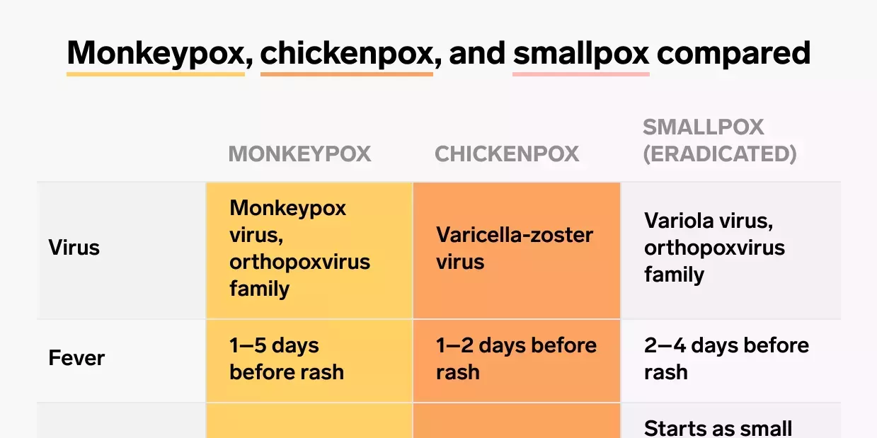 Comparación de los síntomas de la viruela del mono con los de la viruela y la varicela