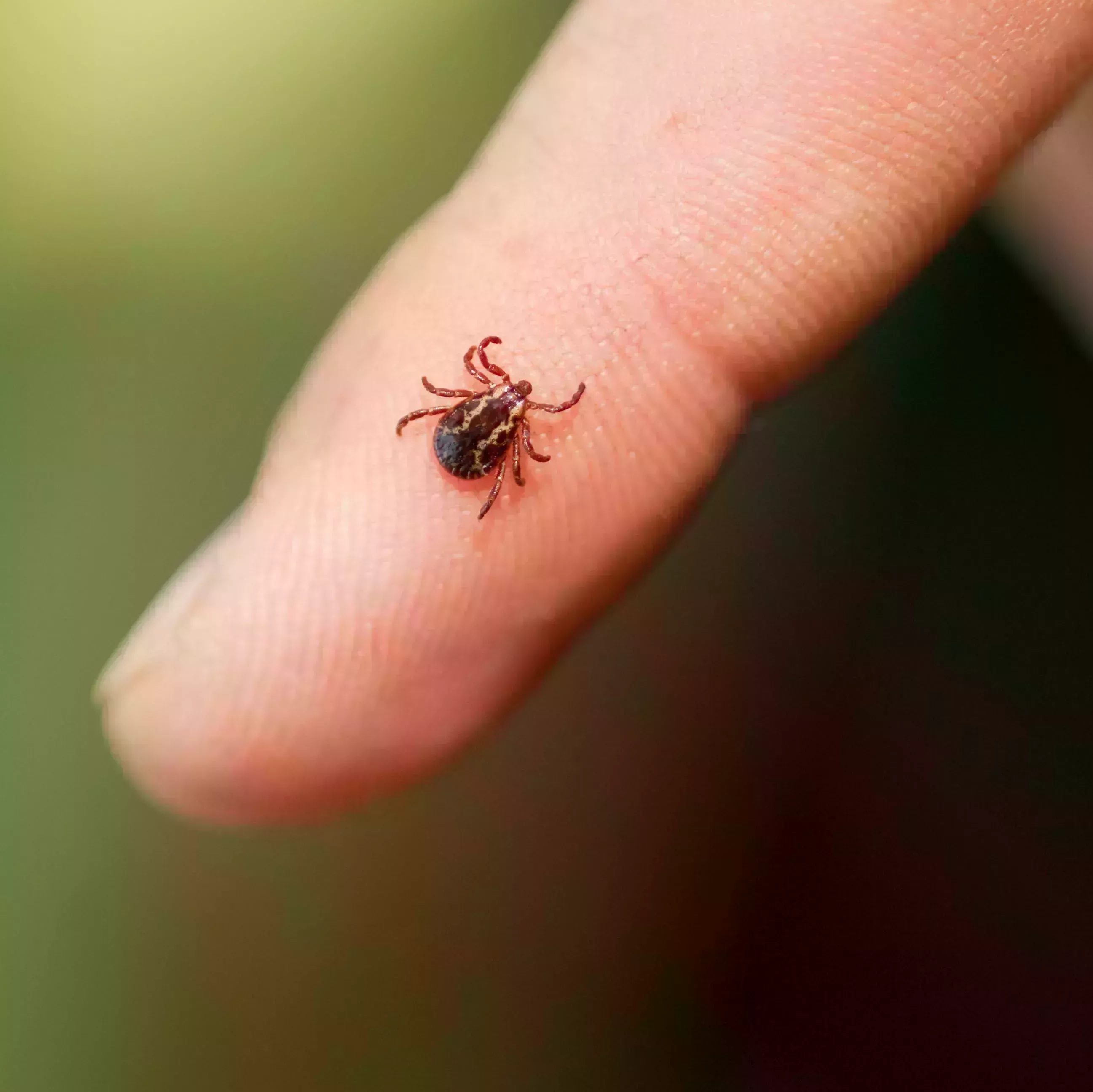 Esta es la única forma de eliminar una cabeza de garrapata clavada en la piel