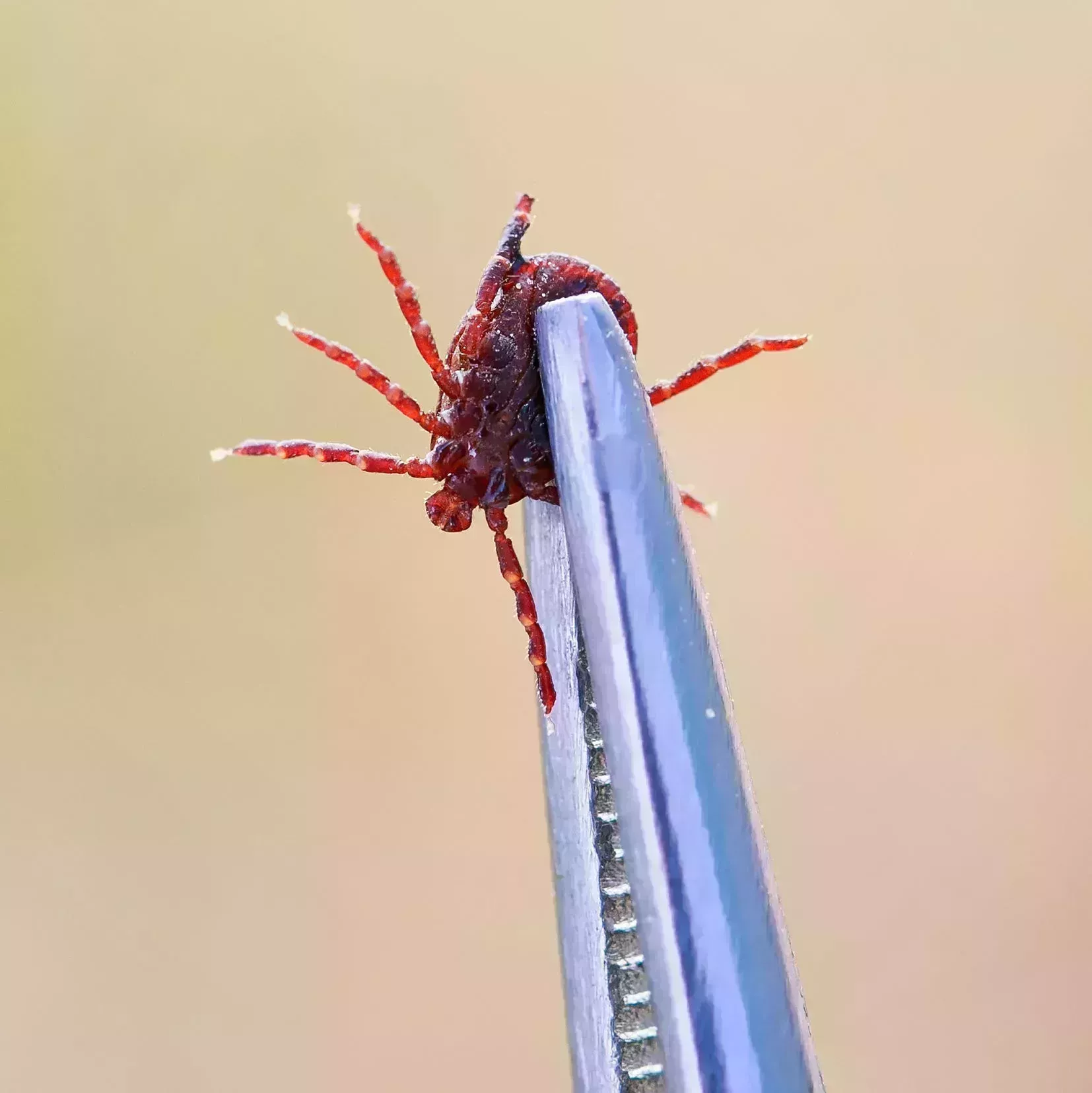 Esta es la única forma de eliminar una cabeza de garrapata clavada en la piel
