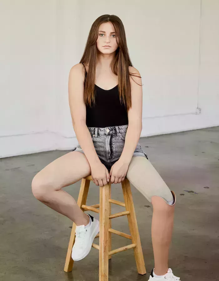 ¡EXCLUSIVA! Caylee Blosenski habla en serio sobre la amputación que le salvó la vida