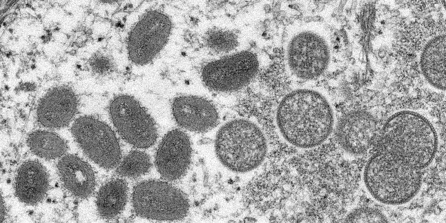 Periodistas africanos condenan a los medios de comunicación por utilizar imágenes de personas negras en la cobertura de los brotes de viruela del mono en Estados Unidos y Reino Unido