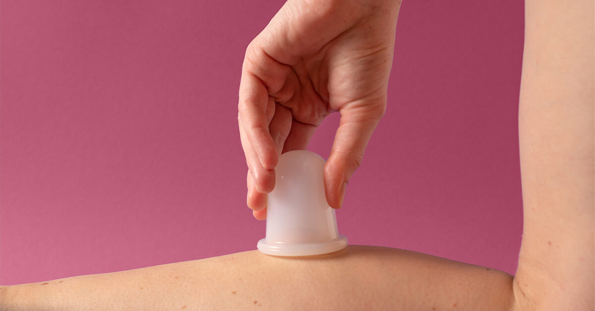 ¿Pueden las ventosas alisar realmente la celulitis?