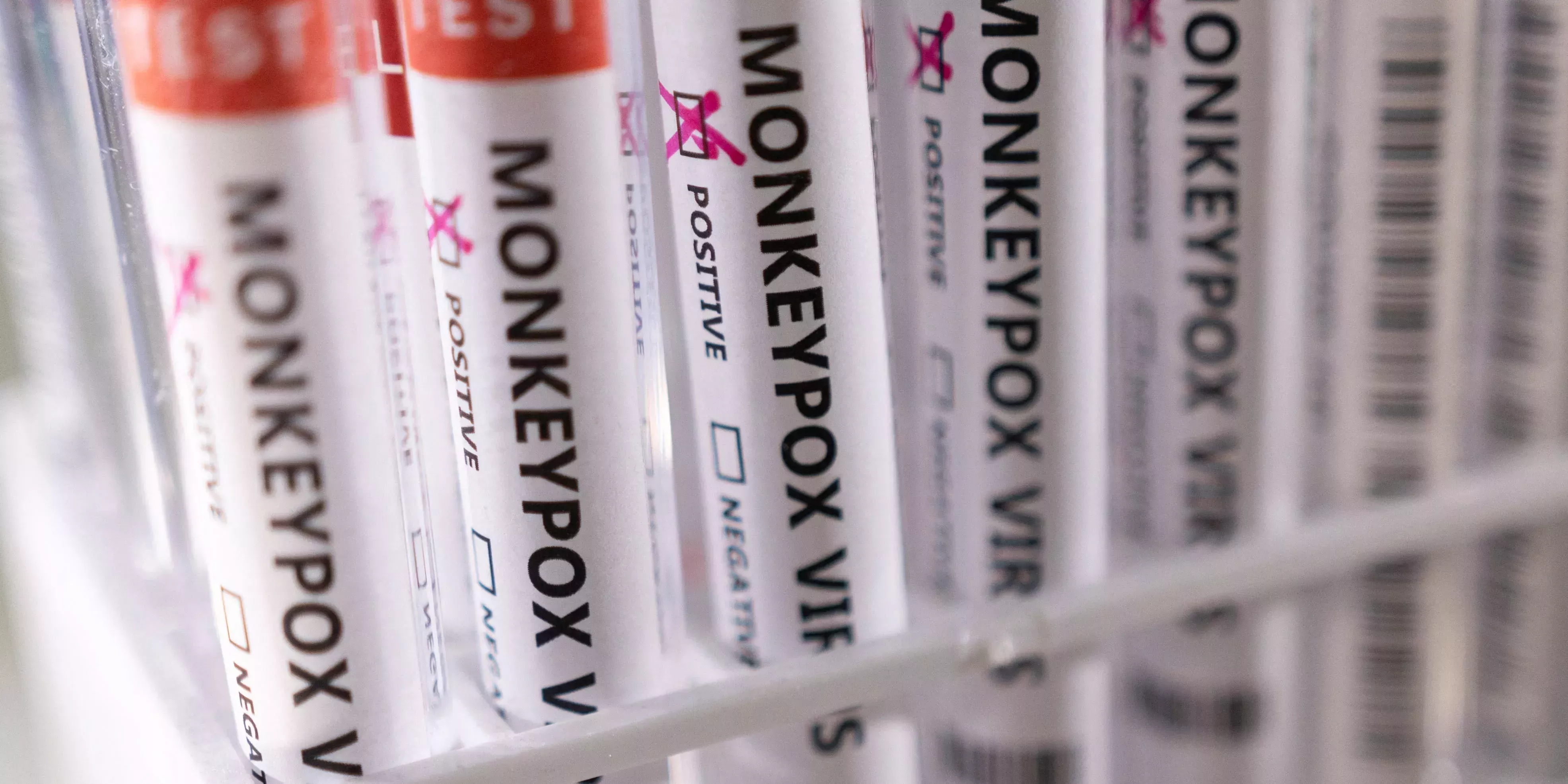 Los CDC aconsejan a las personas que creen haber estado expuestas a la viruela del mono que se distancien socialmente mientras se 