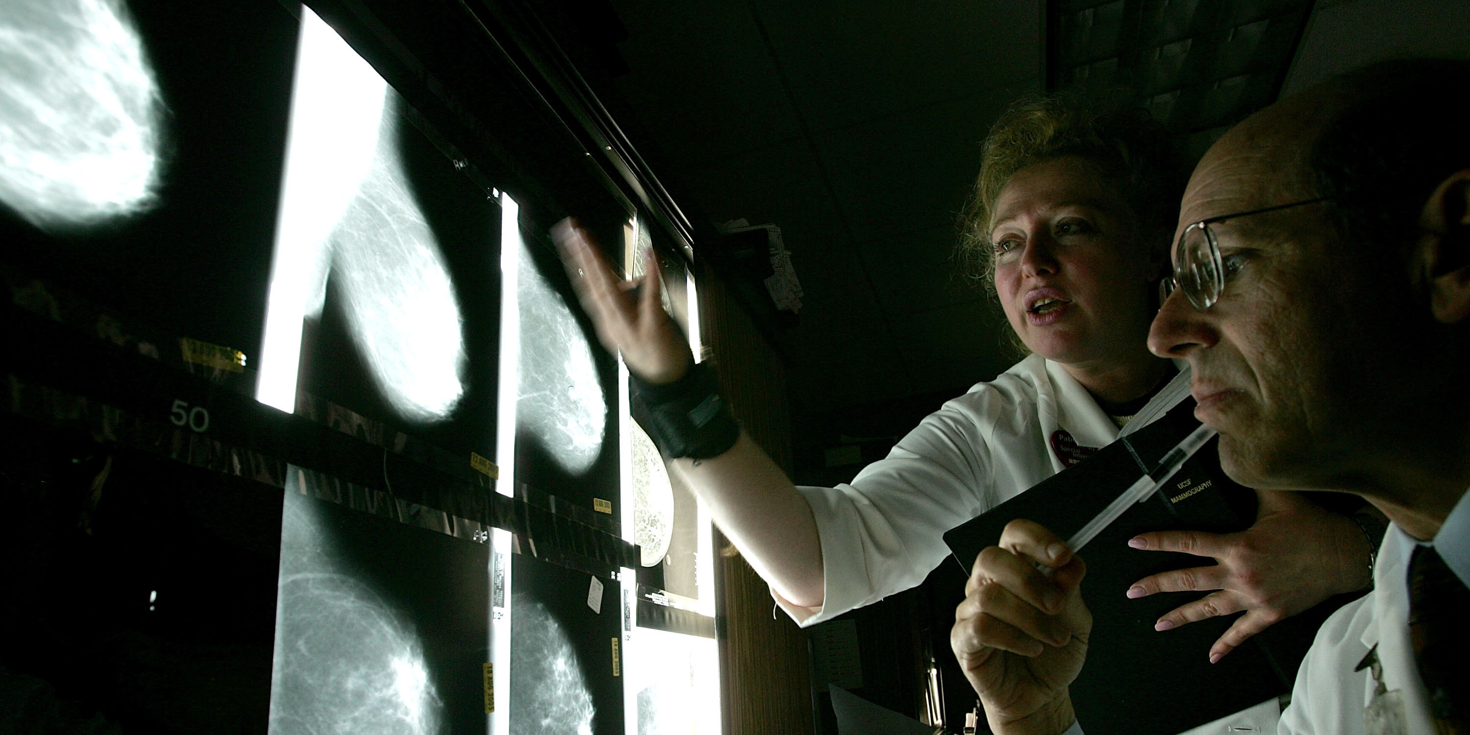 Una joven de 24 años intentó reventar lo que creía que era un grano en el pecho, pero luego descubrió que tenía cáncer de mama