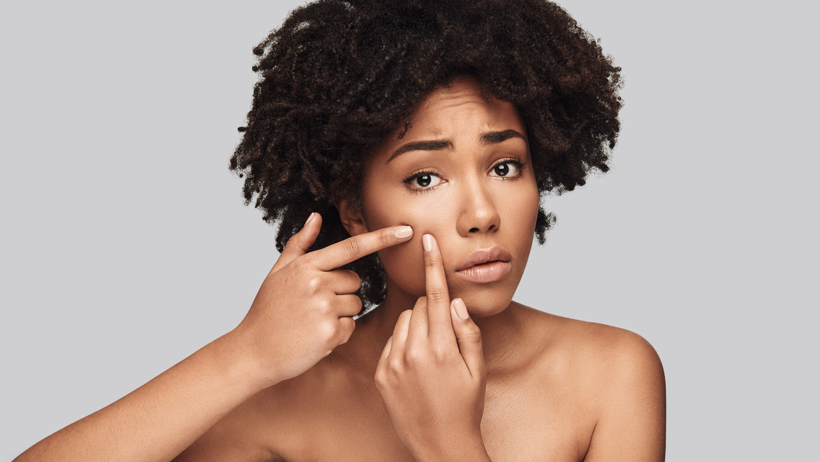 Este remedio para el acné favorito de los fans demuestra su valor una vez más