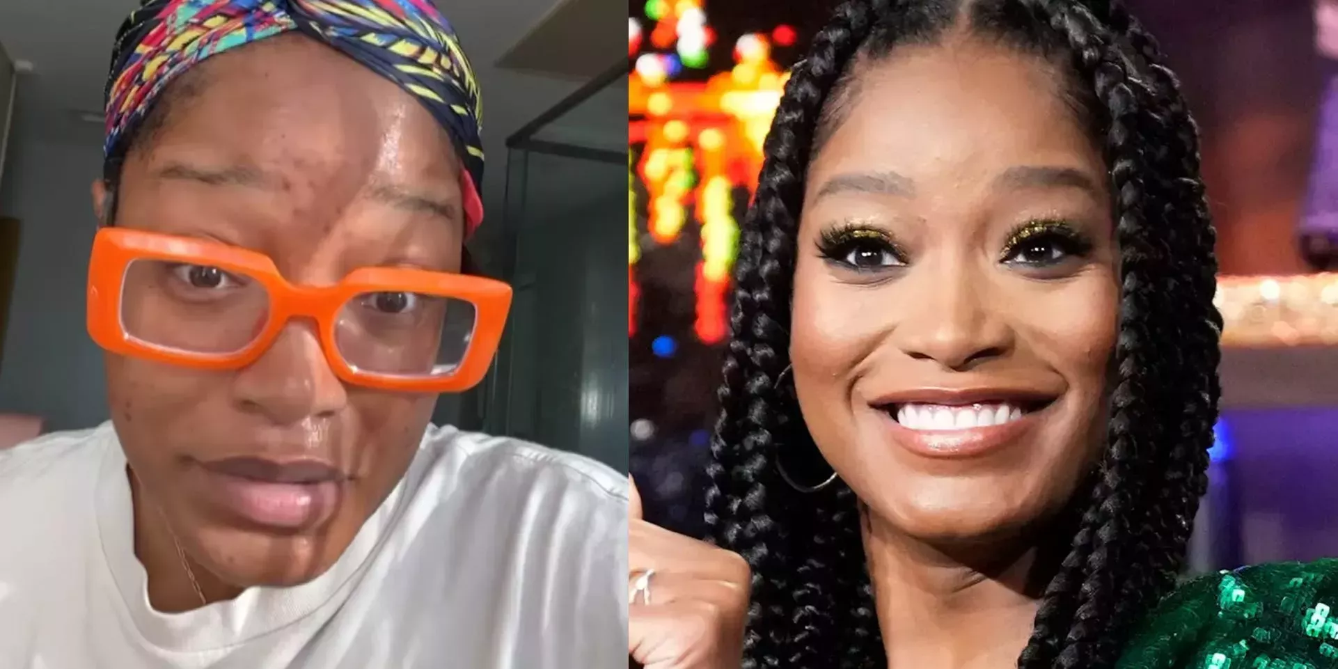 Keke Palmer se abre a sus fans sobre su acné adulto en un vídeo de Instagram y pide a los cirujanos plásticos que encuentren una cura