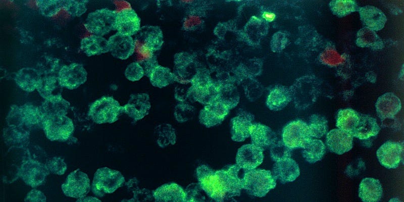 Un adolescente se infecta con una ameba que comía su cerebro poco a poco
