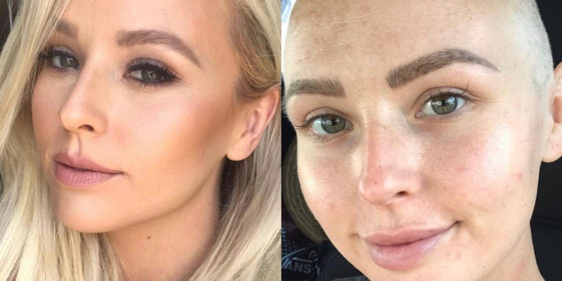 Una mujer de 29 años con un bulto en el pecho dice que le negaron una mamografía por ser demasiado joven