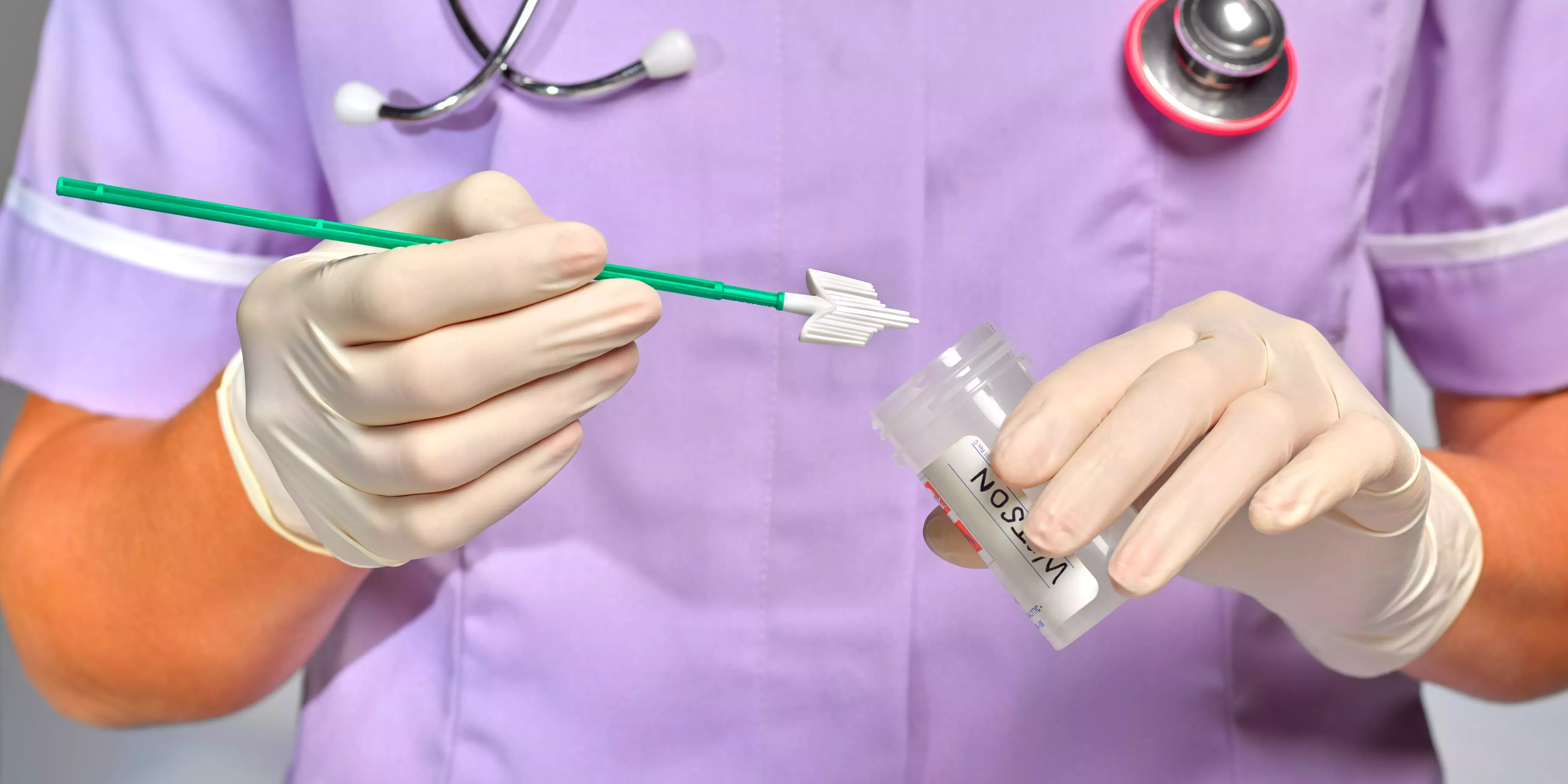 3 signos fáciles de pasar por alto del cáncer de cuello uterino, como el dolor pélvico y el flujo anormal