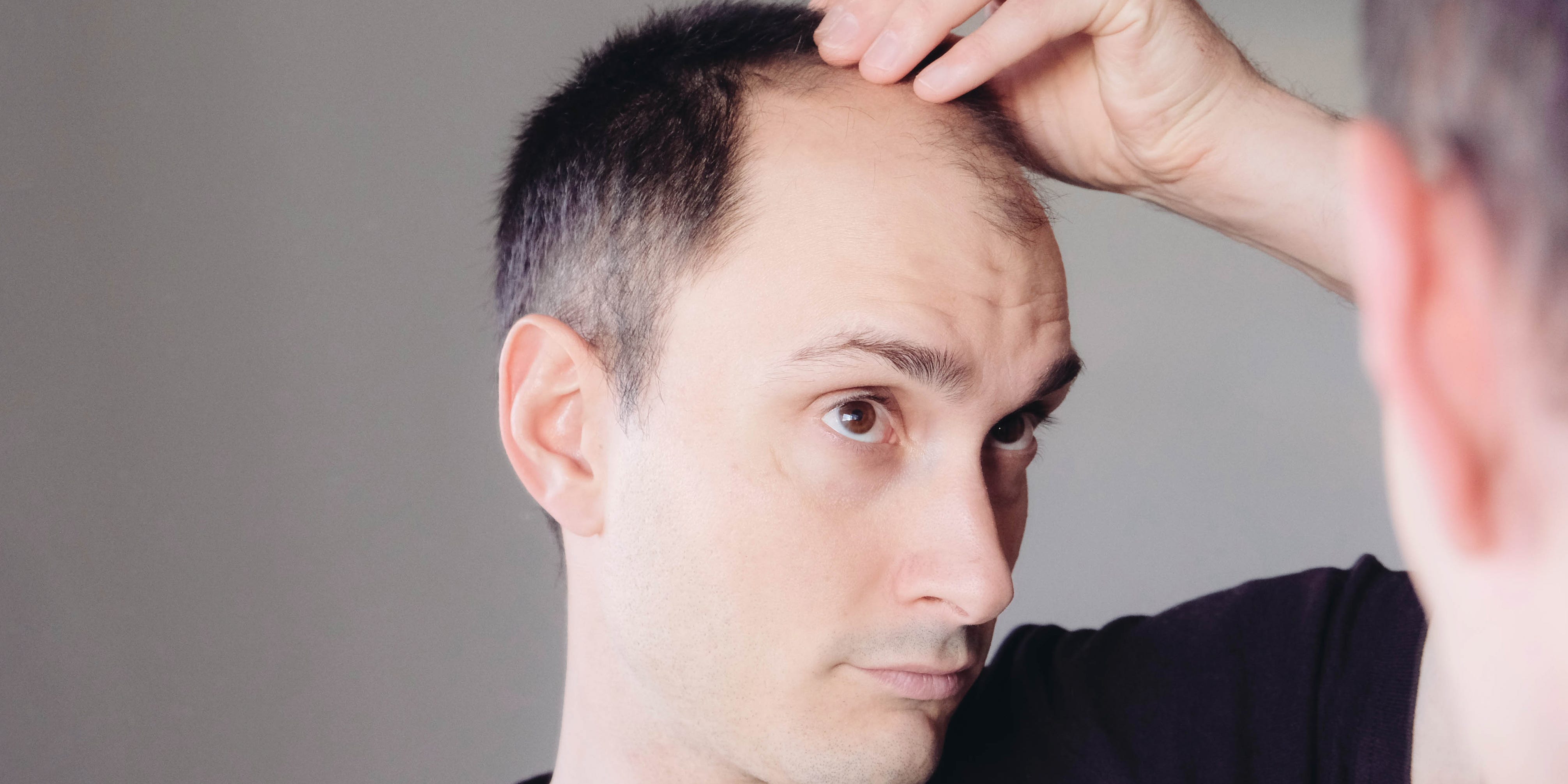 4 cambios en el estilo de vida que los hombres pueden hacer ahora para prevenir la caída temprana del cabello, según un dermatólogo