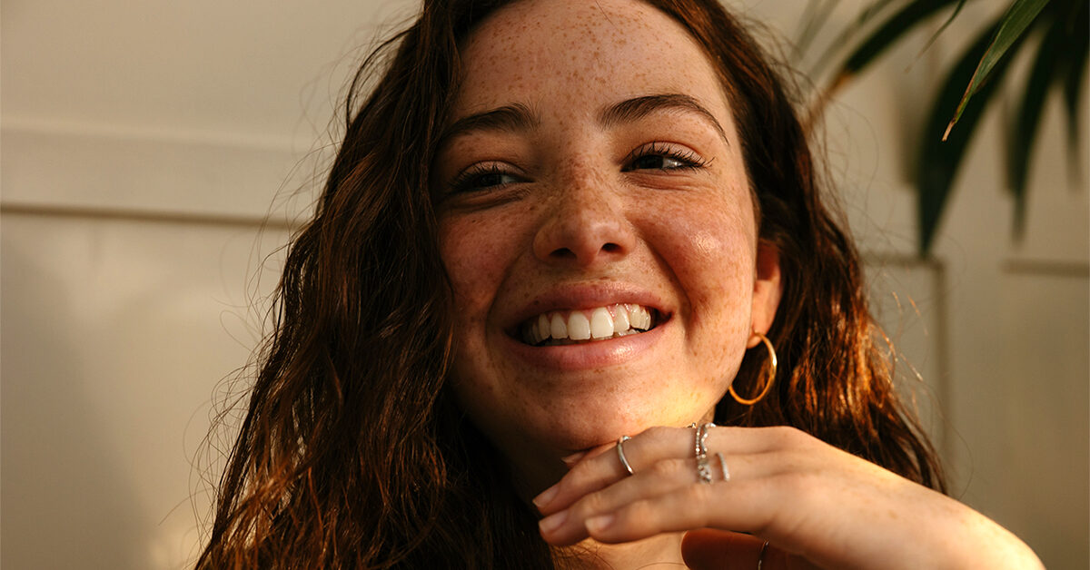 Entonces, ¿cómo se eliminan las pecas?