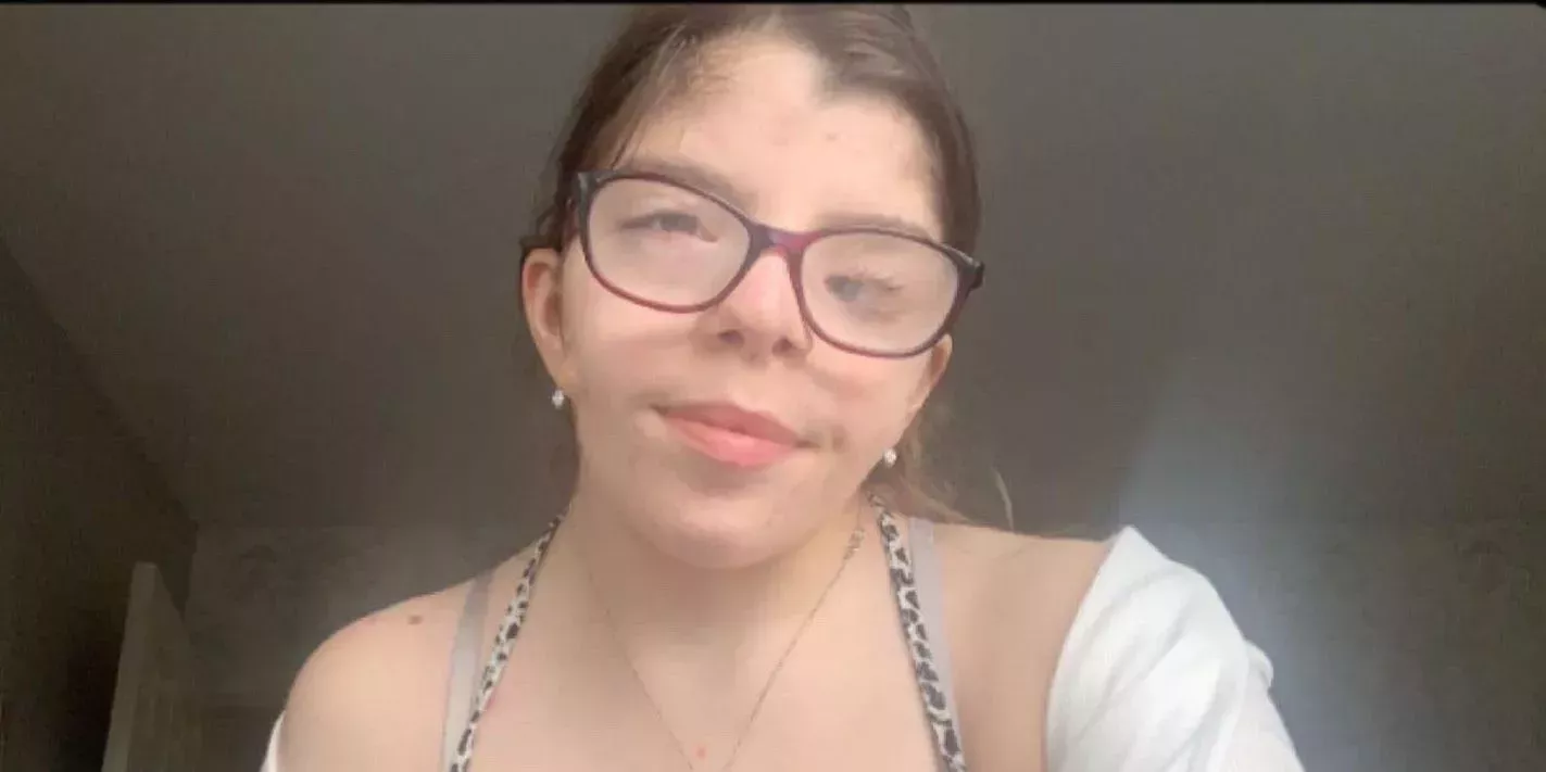 Pretendo ser una celebridad cuando la gente se fija en mi diferencia facial. Me ha convertido en una persona más segura de sí misma.