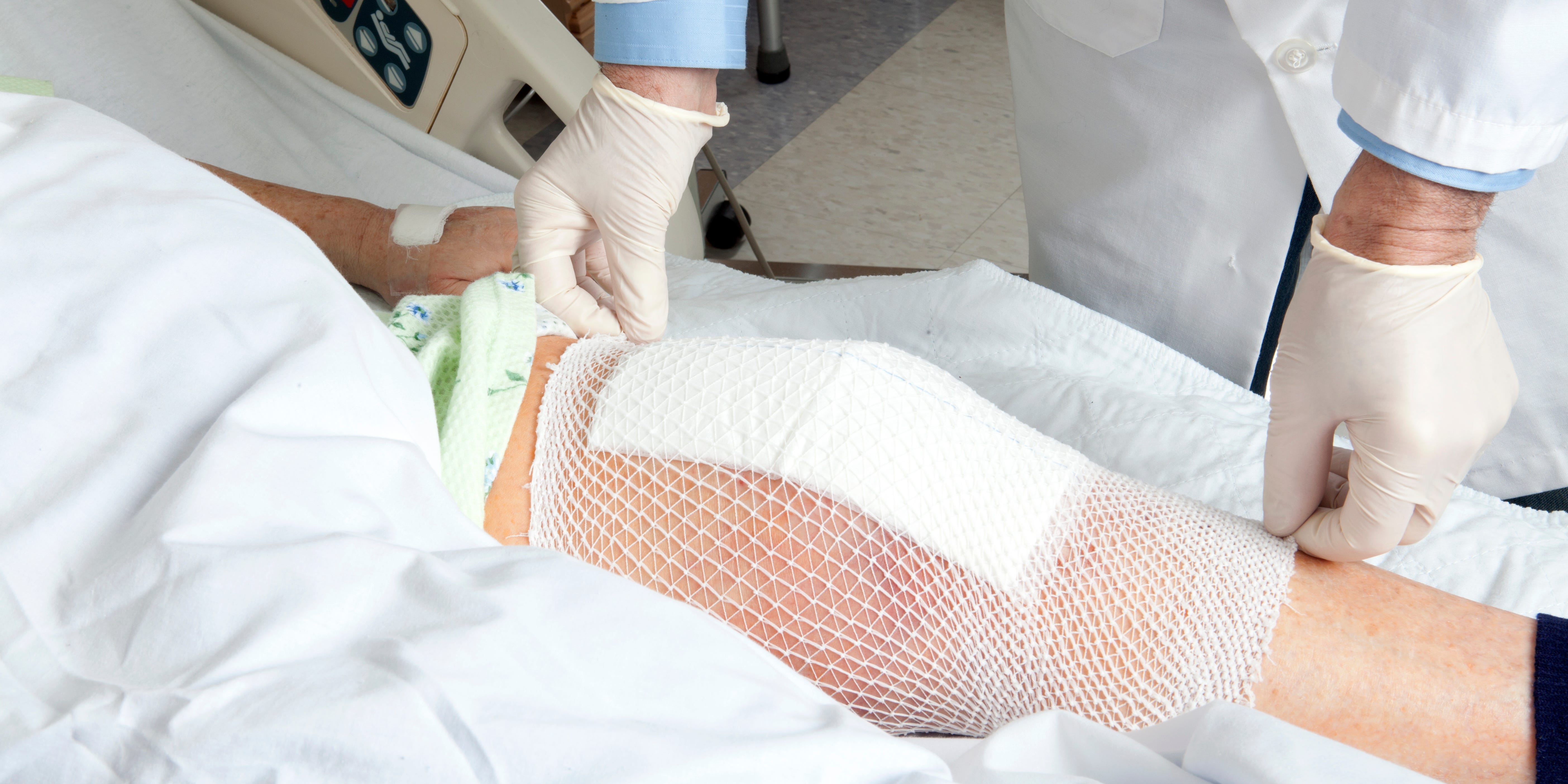 Una joven con la enfermedad de Lyme sin diagnosticar se debilitó gradualmente hasta que no pudo sostener un cepillo de dientes - y finalmente necesitó 16 cirugías en las articulaciones