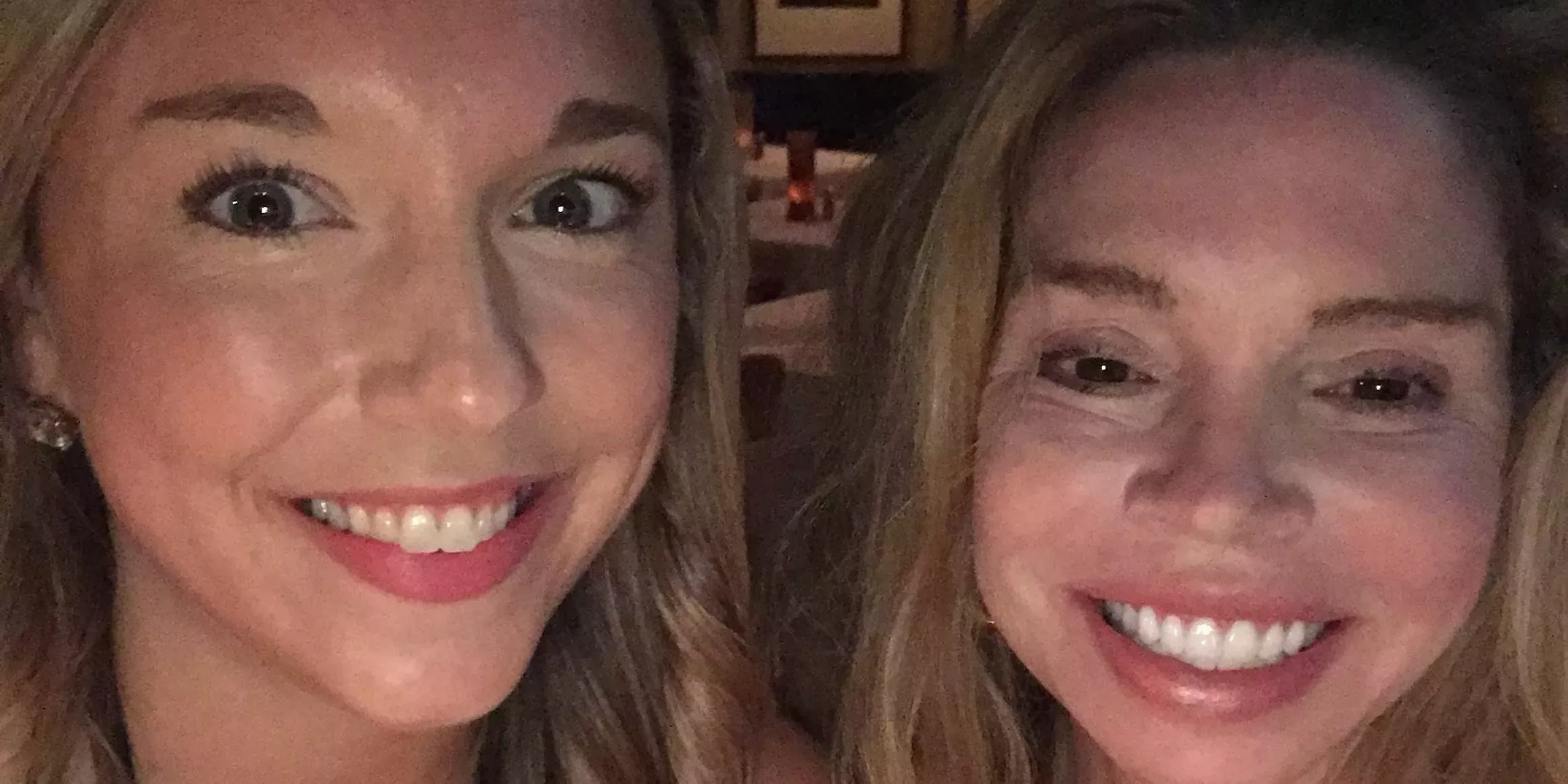 La lesión cerebral traumática de mi madre cambió su personalidad: esto es lo que noté y cómo lo afronté