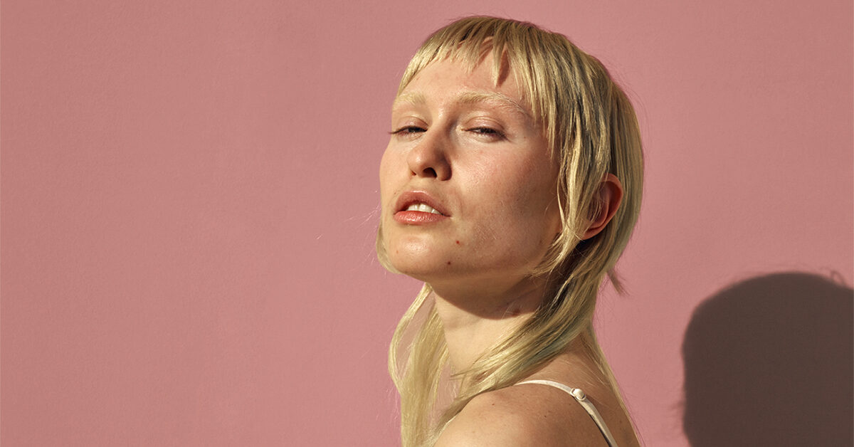 ¡Al rescate! Así es como se eliminan las rojeces del acné 