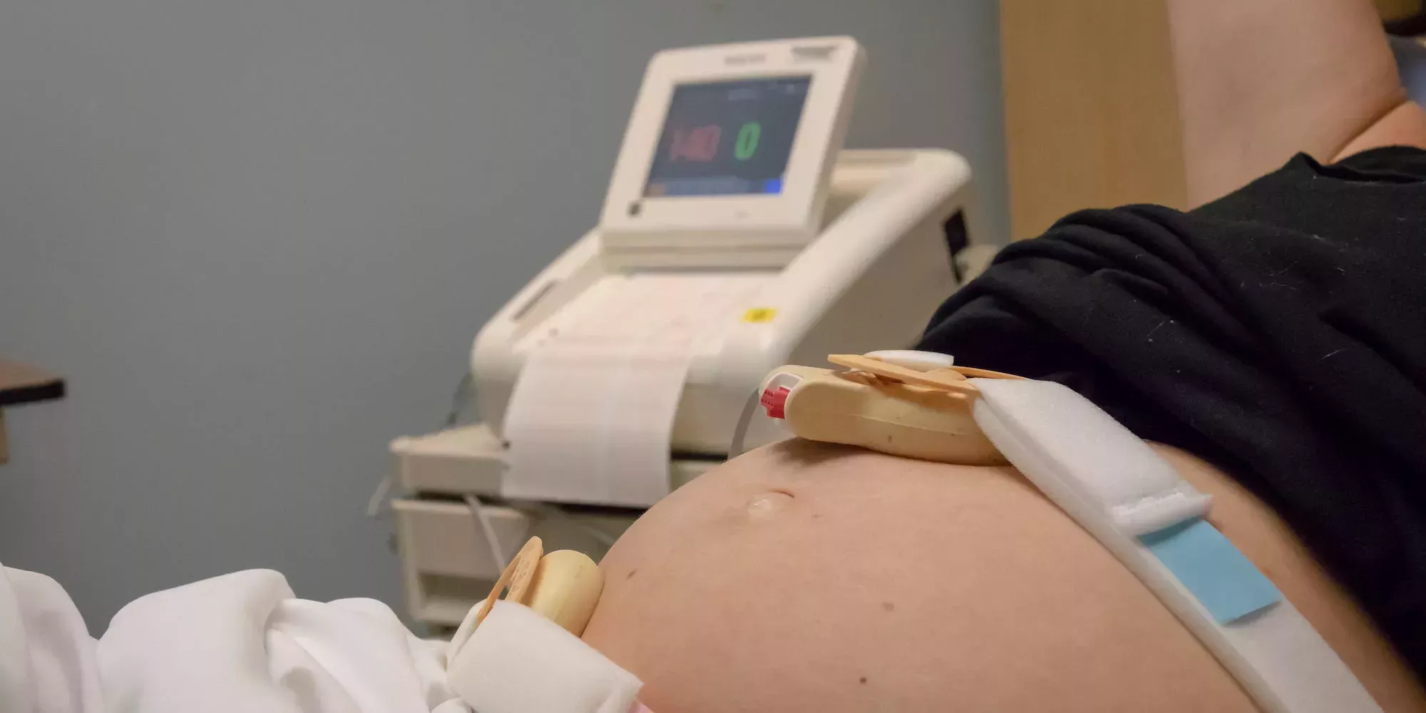 La ex señora de Carolina del Sur dice que fue obligada a llevar a su feto hasta las 25 semanas, dos meses después de que los médicos le detectaran un defecto cardíaco mortal