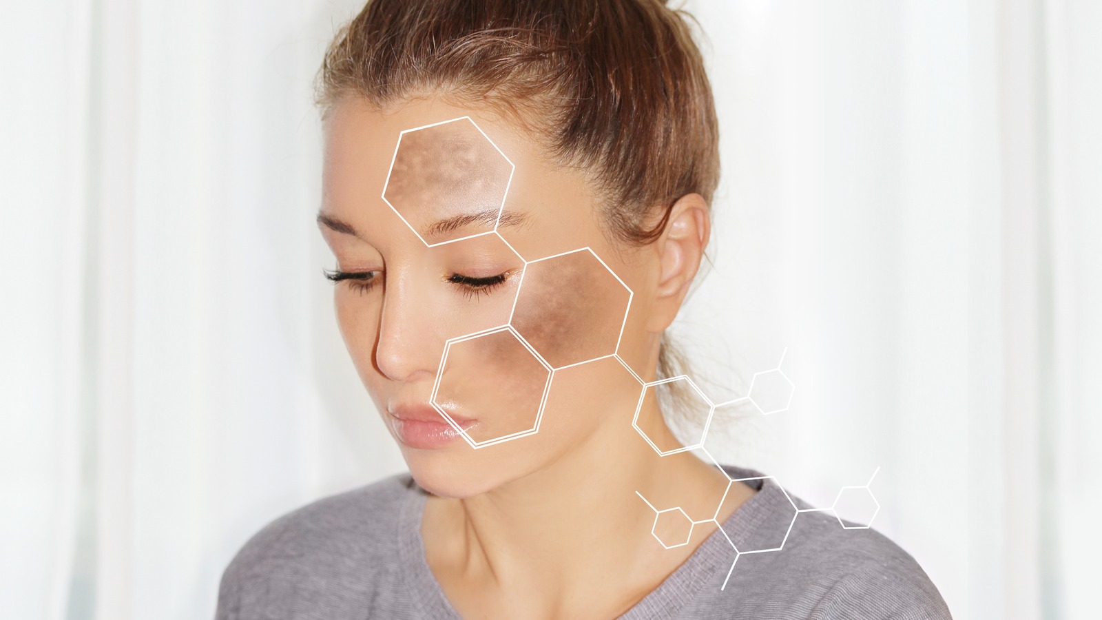 Por qué evitar las cremas aclaradoras con hidroquinona.