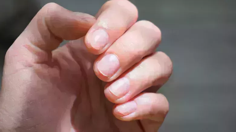 Los mayores errores que todo el mundo comete con las uñas de gel - La lista