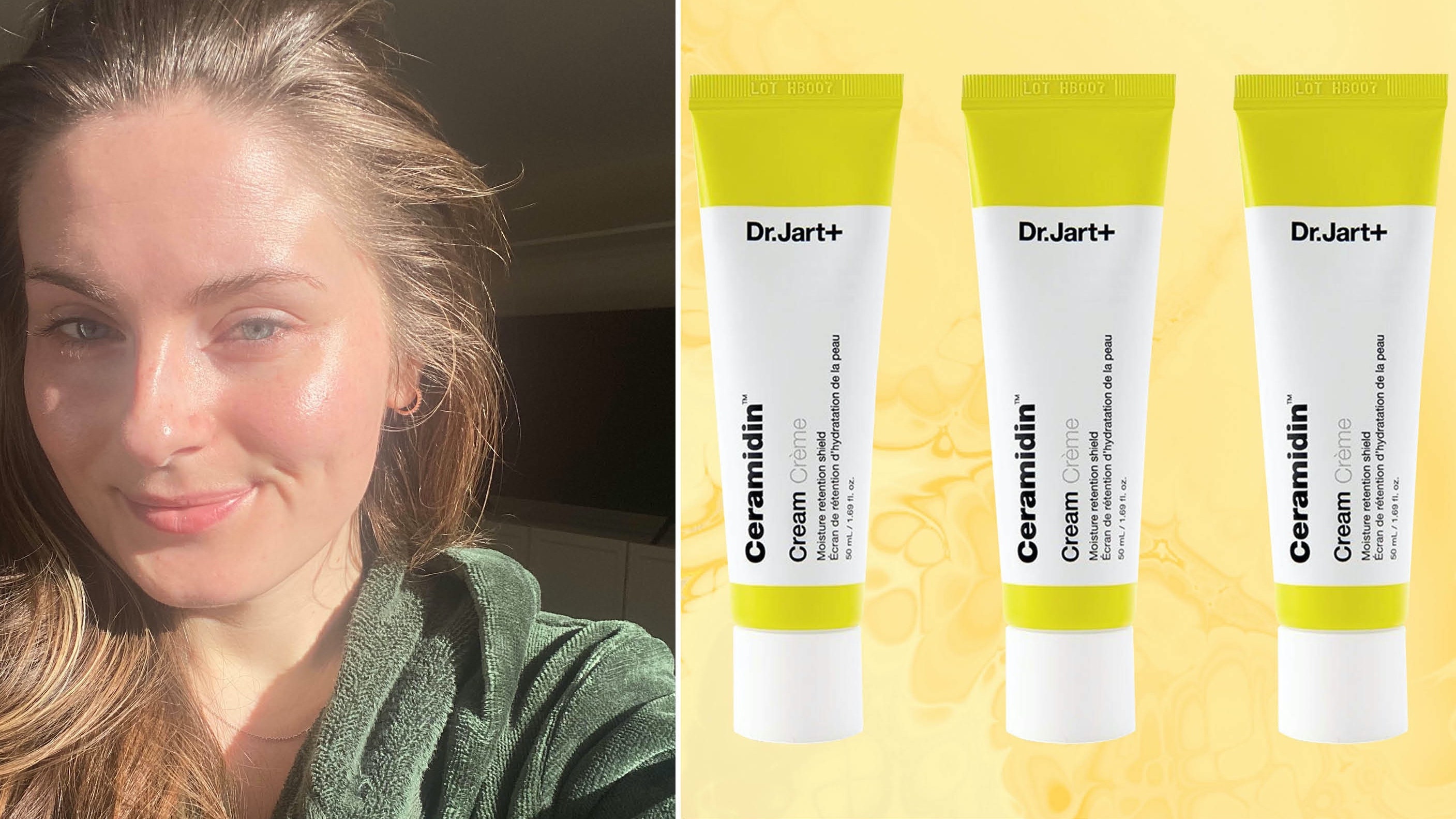 Por fin una crema hidratante que calma mi piel propensa a la rosácea