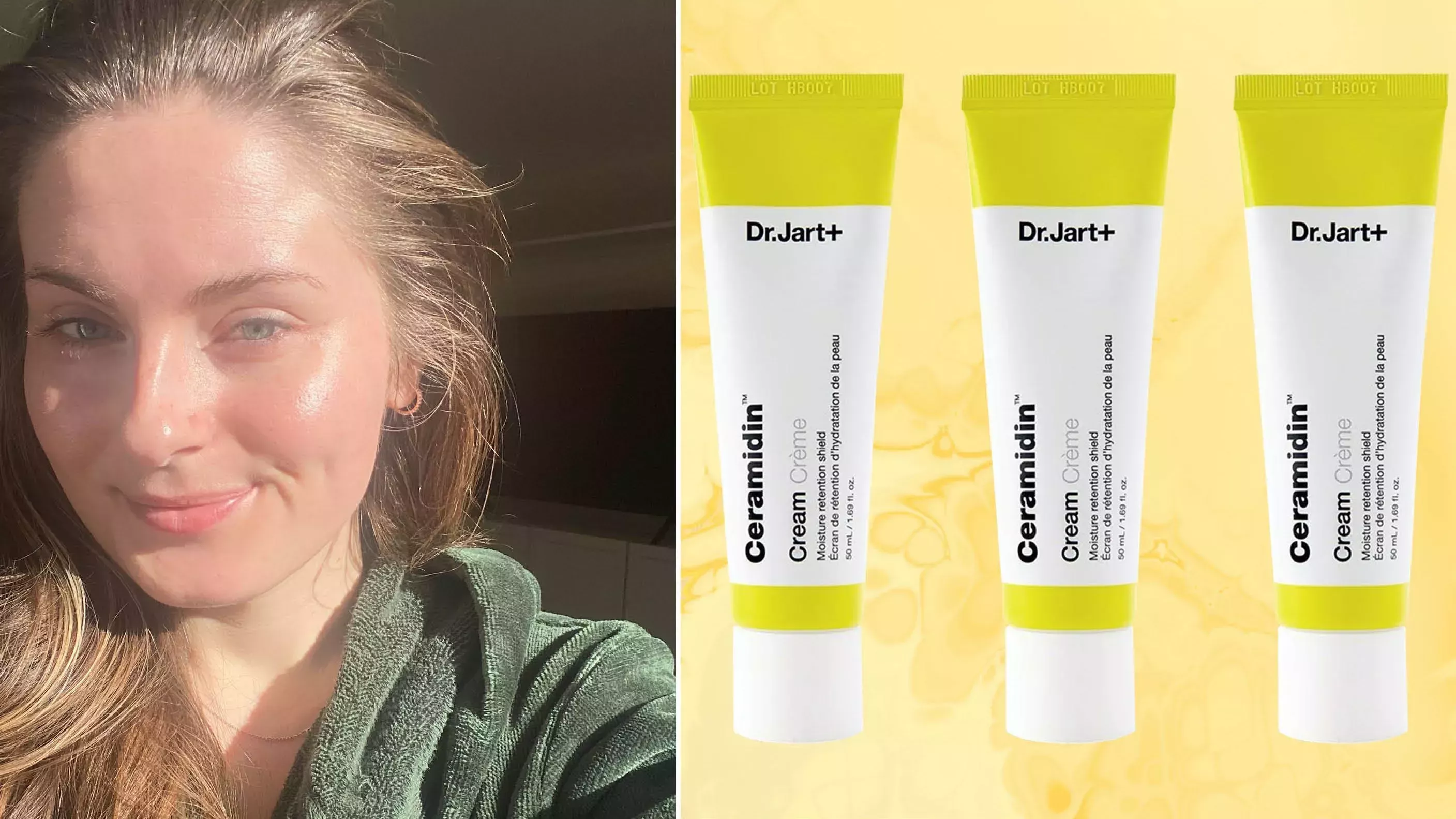 Por fin una crema hidratante que calma mi piel propensa a la rosácea