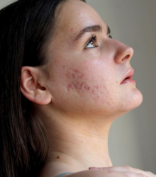 Cómo aprender a amar tu piel