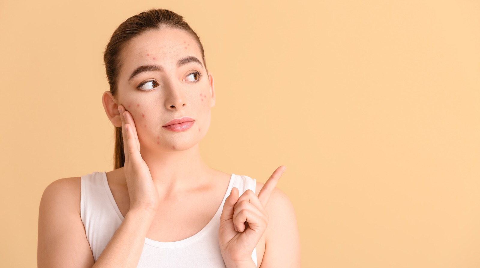 Las mejores formas de prevenir los brotes de acné durante los tratamientos de fertilidad