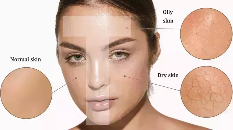 11 errores en el cuidado de la piel que están causando tu piel grasa