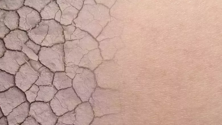 11 errores en el cuidado de la piel que están causando tu piel grasa
