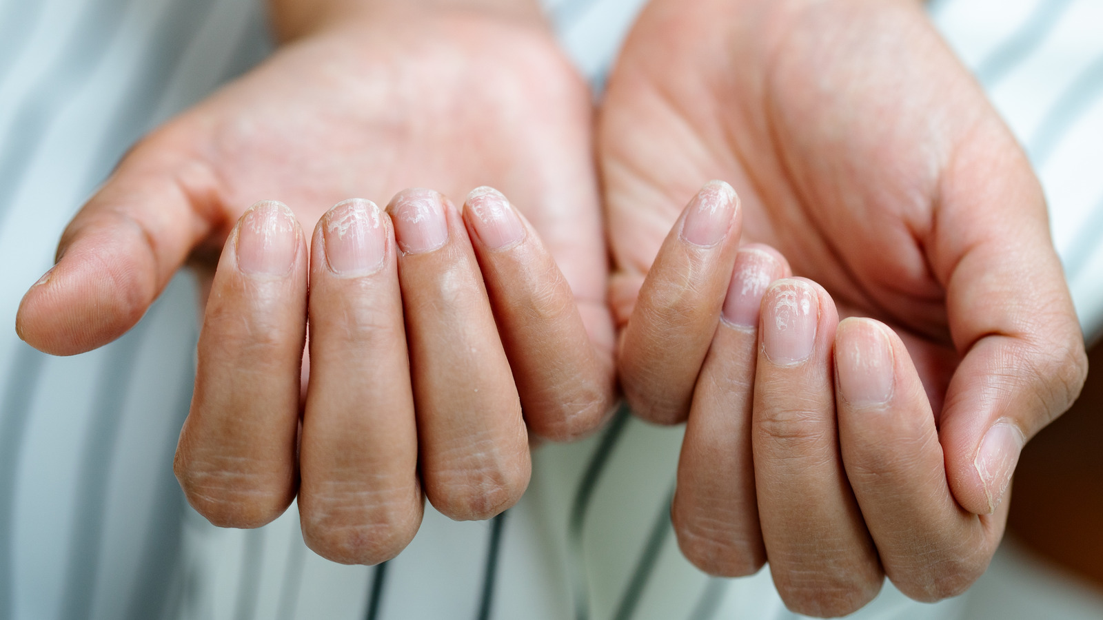 Cómo revivir las uñas dañadas tras demasiada manicura de gel