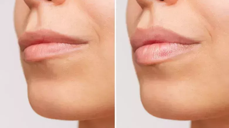 El mal hábito que podría ser la causa oculta de las arrugas