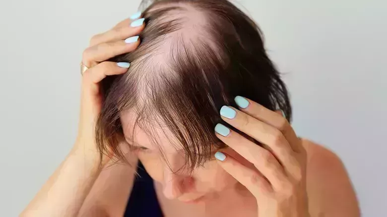 Problemas capilares que no debes ignorar si quieres una cabellera sana