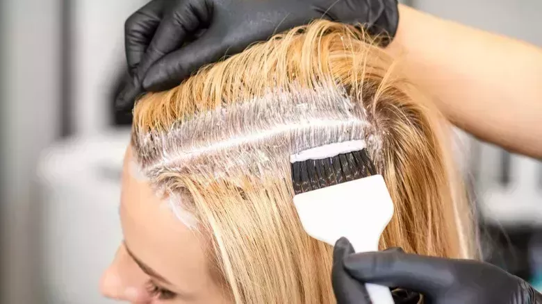 Problemas capilares que no debes ignorar si quieres una cabellera sana