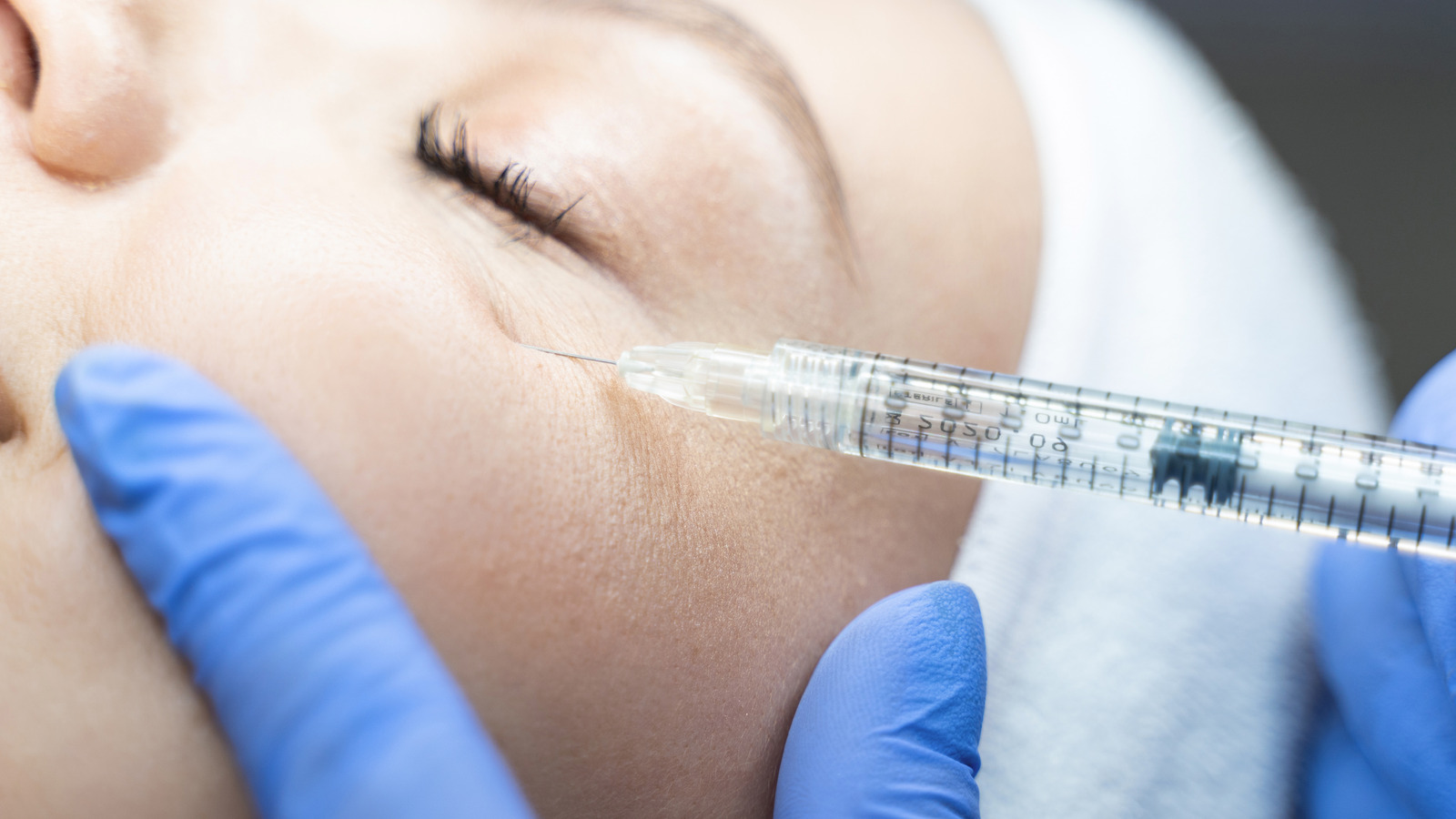 Respuestas a sus principales preguntas sobre el relleno de ojeras