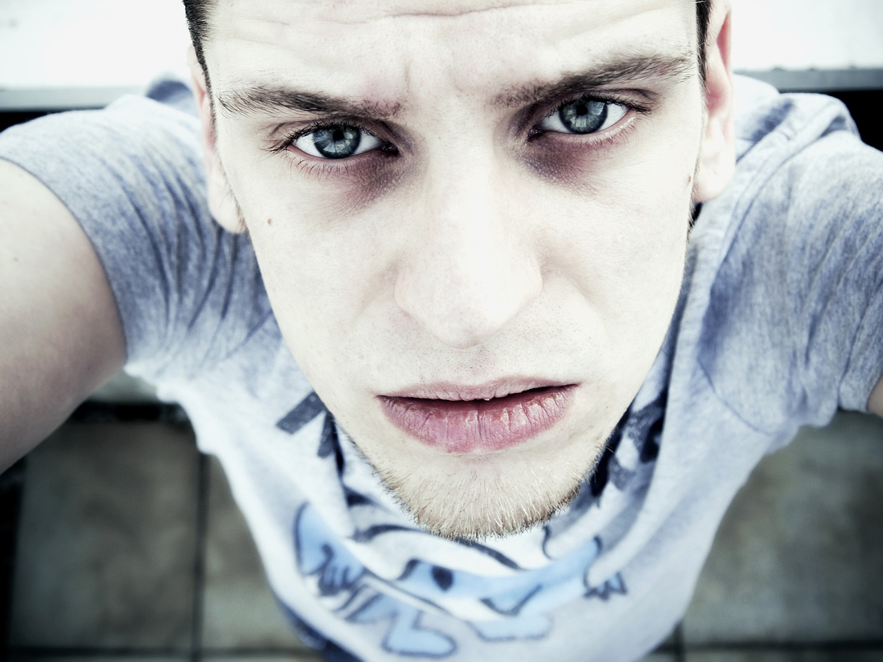 ¿Cuánto dura el relleno en ojeras?